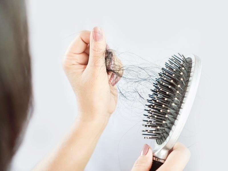 Tóc rụng nhiều sau mỗi lần chải có thể là do cơ thể thay đổi nội tiết tố