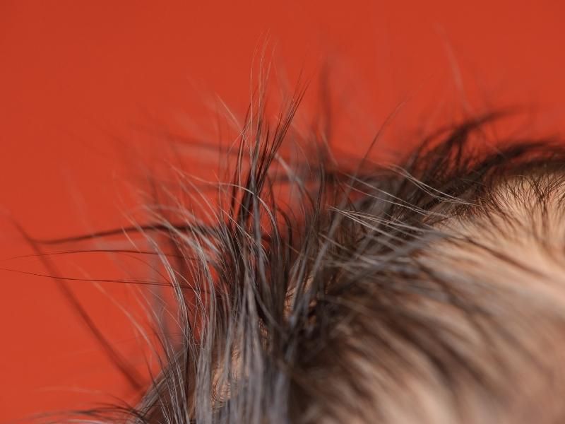 Tóc máu là lớp tóc đầu tiên được mọc ra
