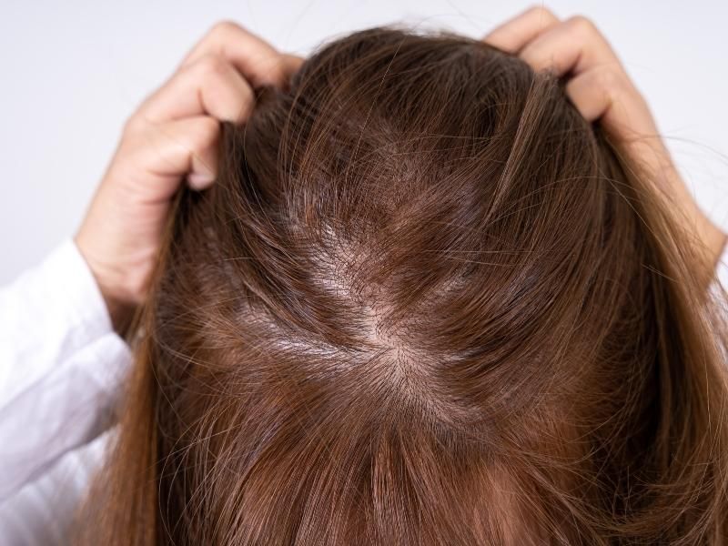 Nếu tóc quá bết mà không kịp gội đầu thì có thể sử dụng dầu gội khô trước khi đi ngủ